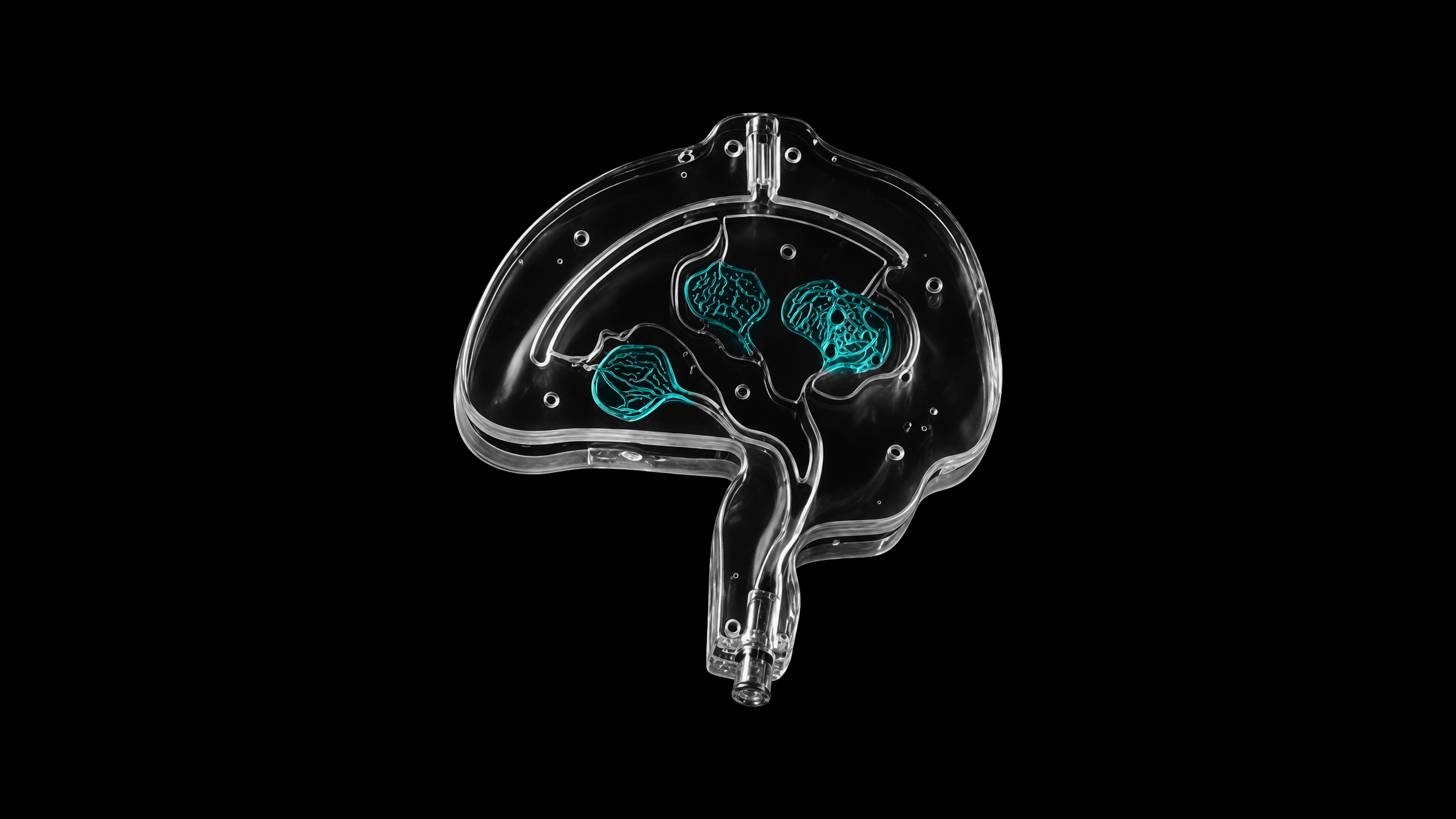 AVM training module with cyan nidus network | SurgeonsLab
