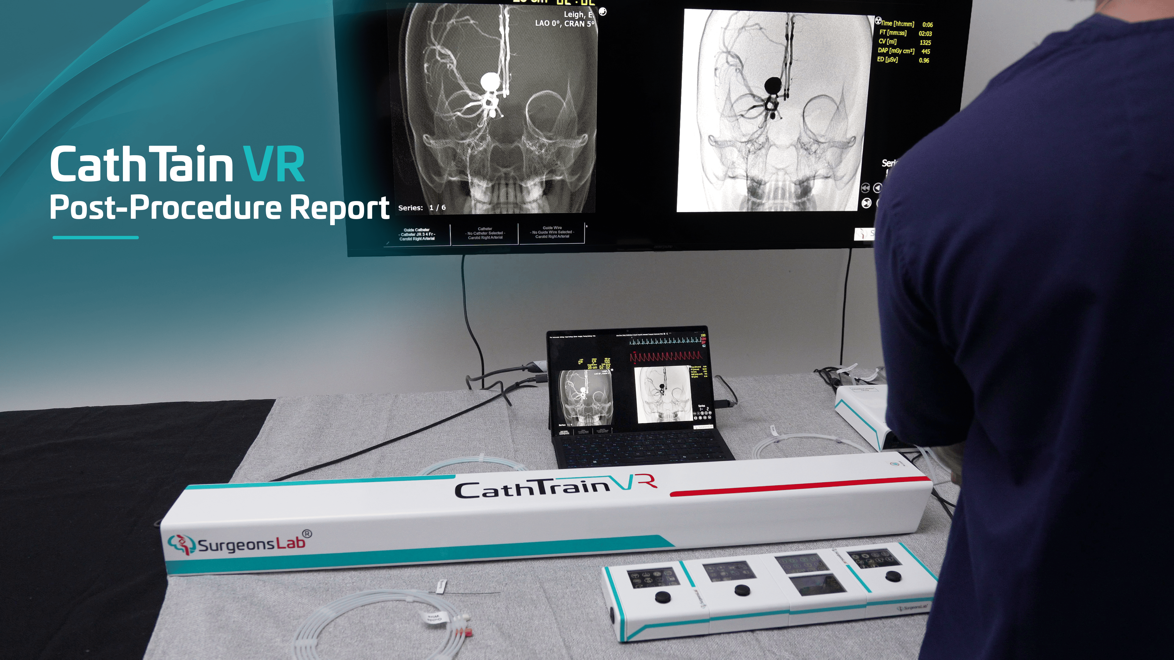 CathTrain VR post-procedure report | SurgeonsLab