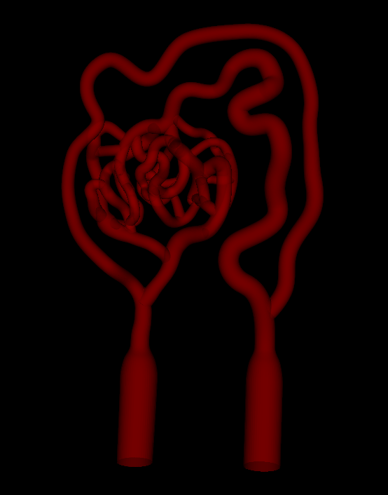 ArterioVenous Malformation Model