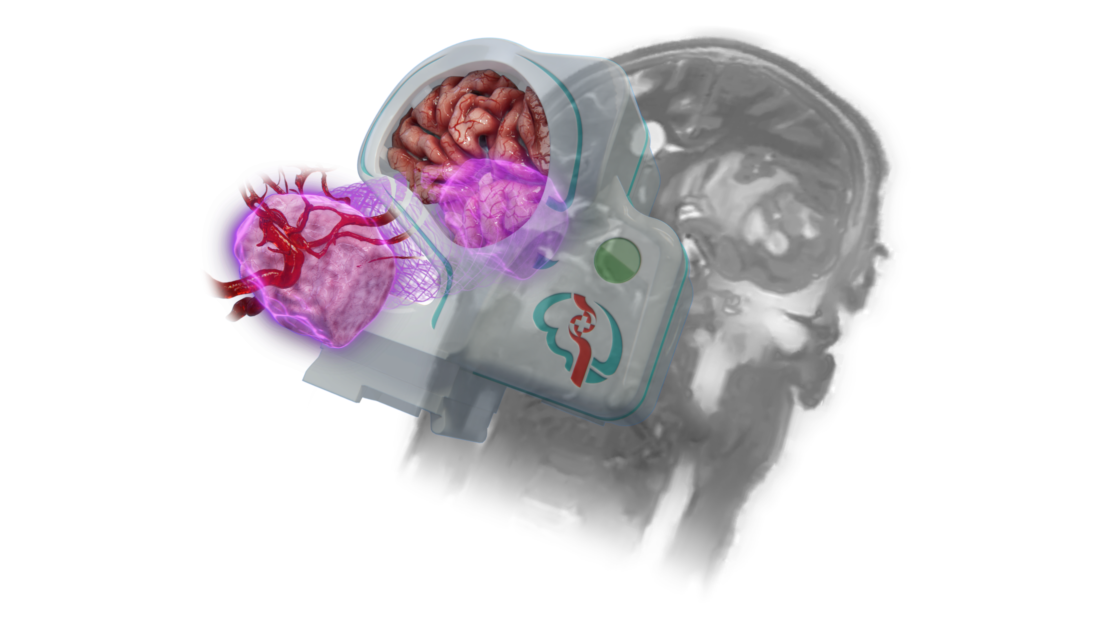 Tumor Resection Models