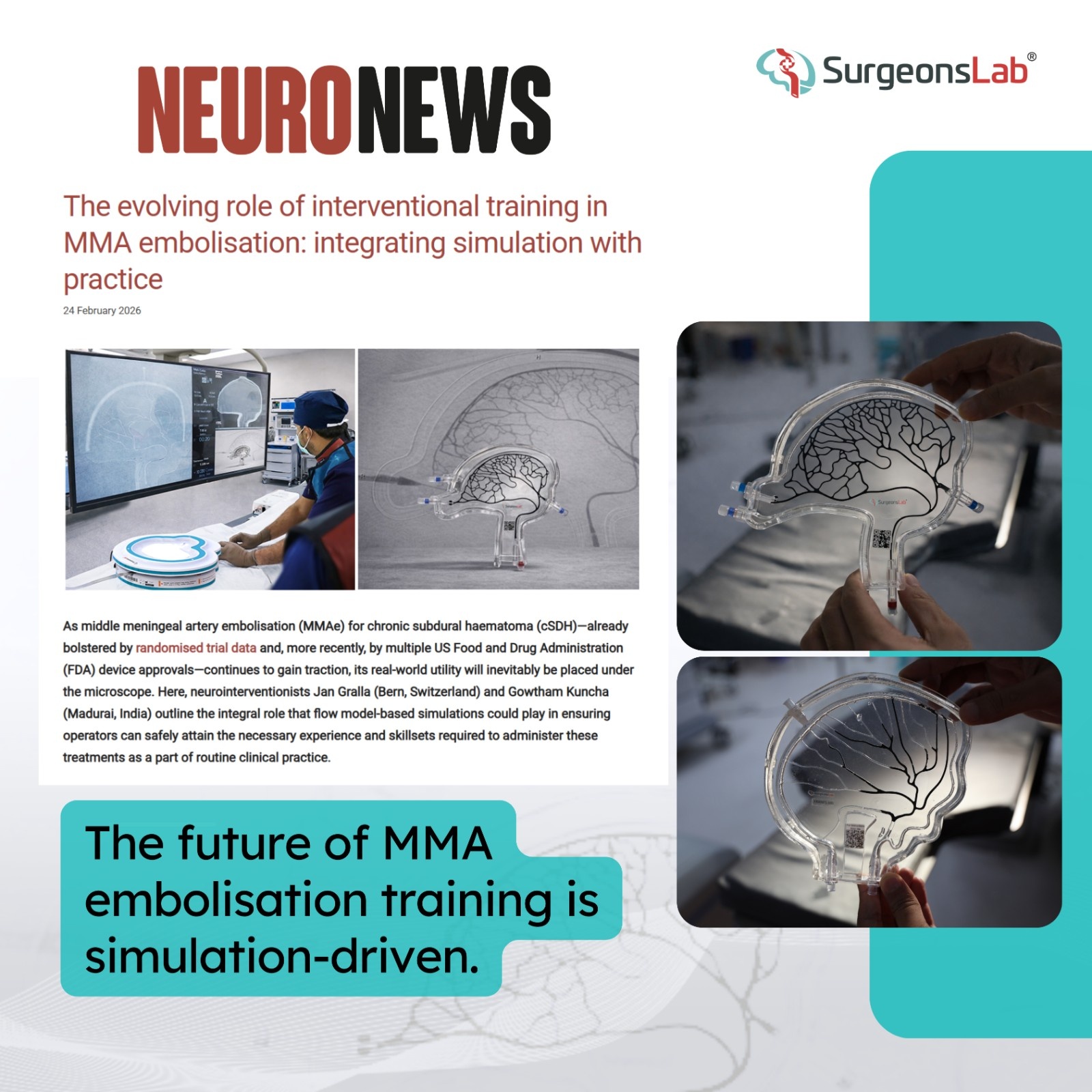 The evolving role of interventional training in MMA embolisation