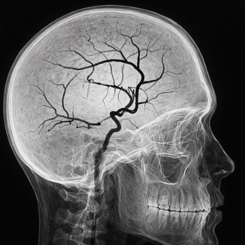 Contrast Agent Control