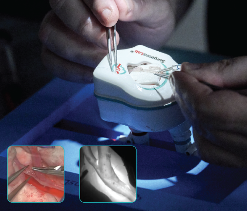 Micro Anastomosis Model