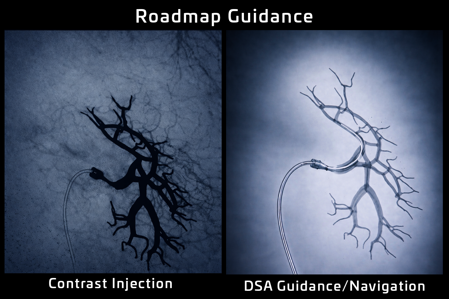 Contrast Agent Control