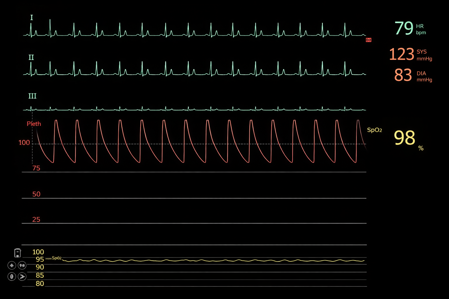 ECG Monitoring