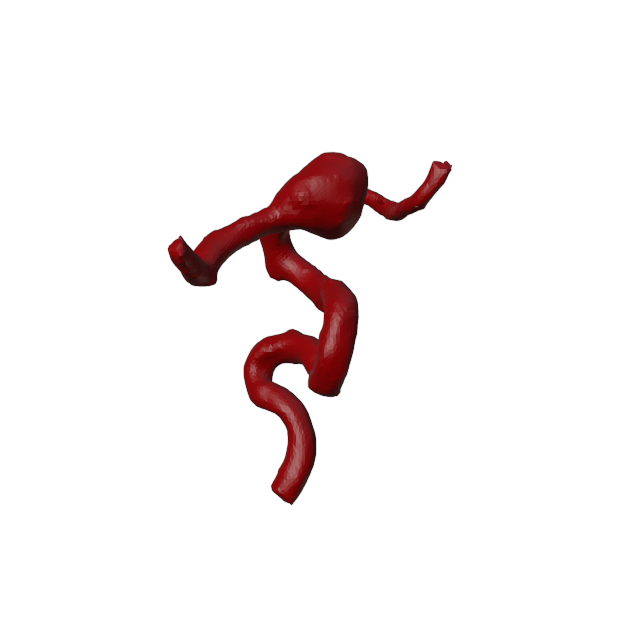 Aneurysm Model