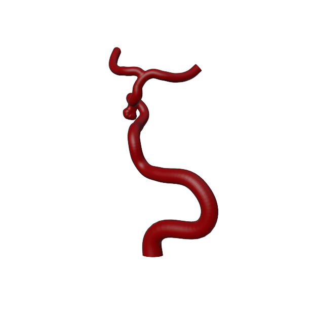 Aneurysm Model