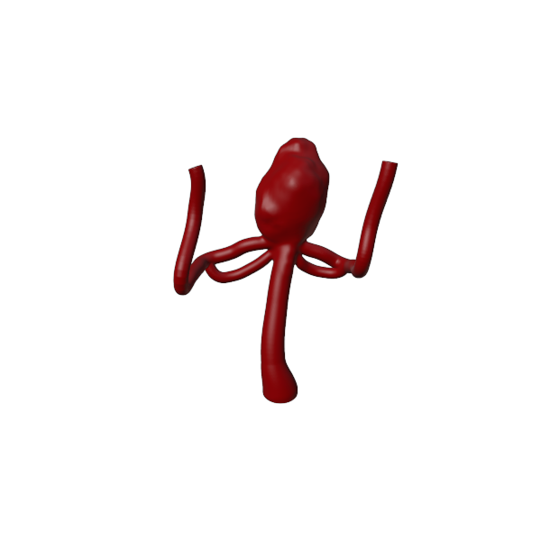 Aneurysm Model