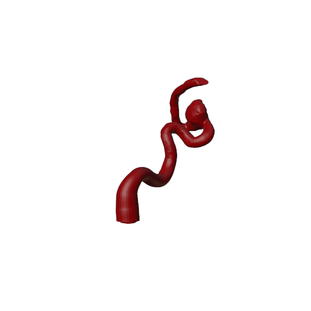 Aneurysm Model