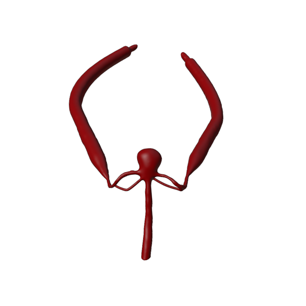 Aneurysm Model