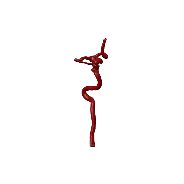 Aneurysm Model