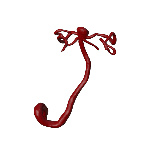 Aneurysm Model