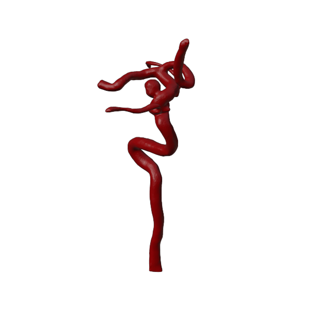 Thrombectomy Model
